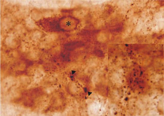 elhelyezkedésében is. Míg az orális vékonybéli szakaszon a varikózus rostok általában kosárszerően körbevették a VGLUT-IR myentericus neuronokat (18.