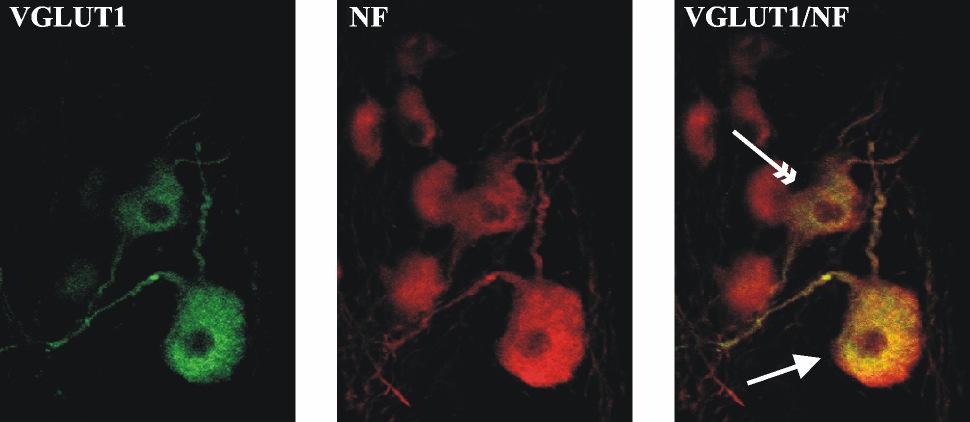 26. ábra Konfokális mikroszkópos felvételek a plexus myentericusról VGLUT1 és neurofilament 200 duplajelöléses immunhisztokémiai festés után.