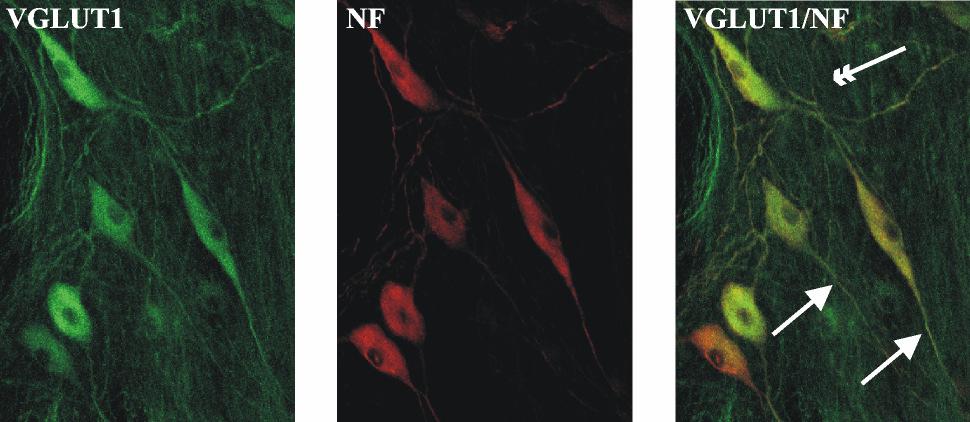 27. ábra Konfokális mikroszkópos felvételek a plexus myentericusról VGLUT1 és neurofilament 200 duplajelöléses immunhisztokémiai festés után.
