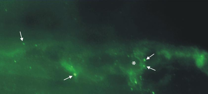 x670 NR2 A festés után a myentericus neuronok mellett több kisebb Cajal-féle interstitialis sejtre emlékeztetı sejtben is láttunk intenzív citoplazmatikus festıdést (31. ábra). 31.