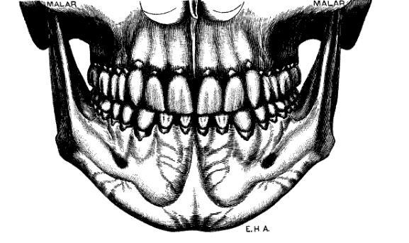 of occlusion and this molar relationship existed so that the mesiobuccal cusp of the upper molar occludes in the buccal groove