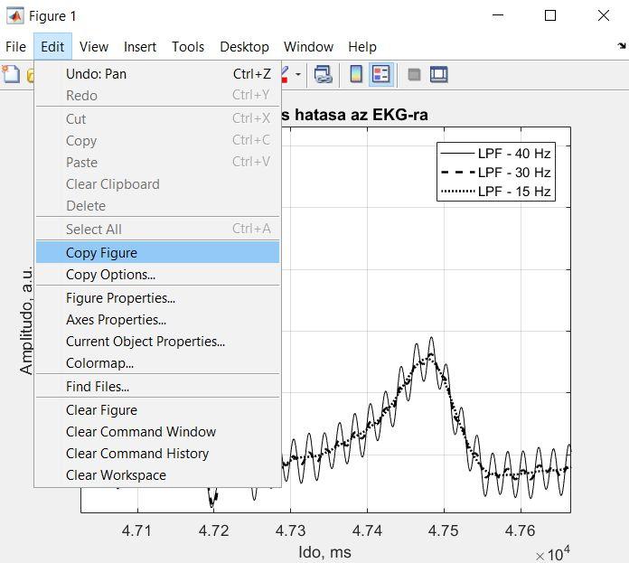 Eredmény: A szures hatasa az EKG-ra 3000 2800 LPF - 40 Hz LPF - 30 Hz LPF - 15 Hz Amplitudo, a.u. 2600 2400 2200 2000 4.71 4.72 4.73 4.74 4.75 4.