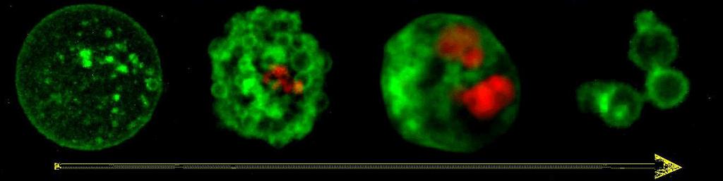 Az apoptózis morfológiája Sejttérfogat csökken (pyknosis) Leválik a környező sejtekről és az extracelluláris mátrixról (szeparáció) A sejtmag zsugorodik (karyopyknosis) A kromatinállomány