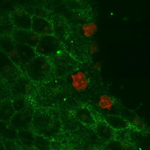 Propidium-iodide Propidium-iodide Az apoptózis vizsgálata Annexin-V jelölés Apoptózis: Foszfatidil-szerin externalizáció Alexa Fluor488 konjugált annexin-v