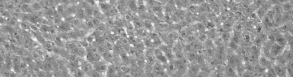 ÇA LAR, ERSAN 5 2.Mikroskobik bulgular Çal man n II. grubunda yer alan deneklerin karaci erlerinin histopatolojik incelemesinde genel olarak dejeneratif de i ikliklerin oldu u tespit edildi.