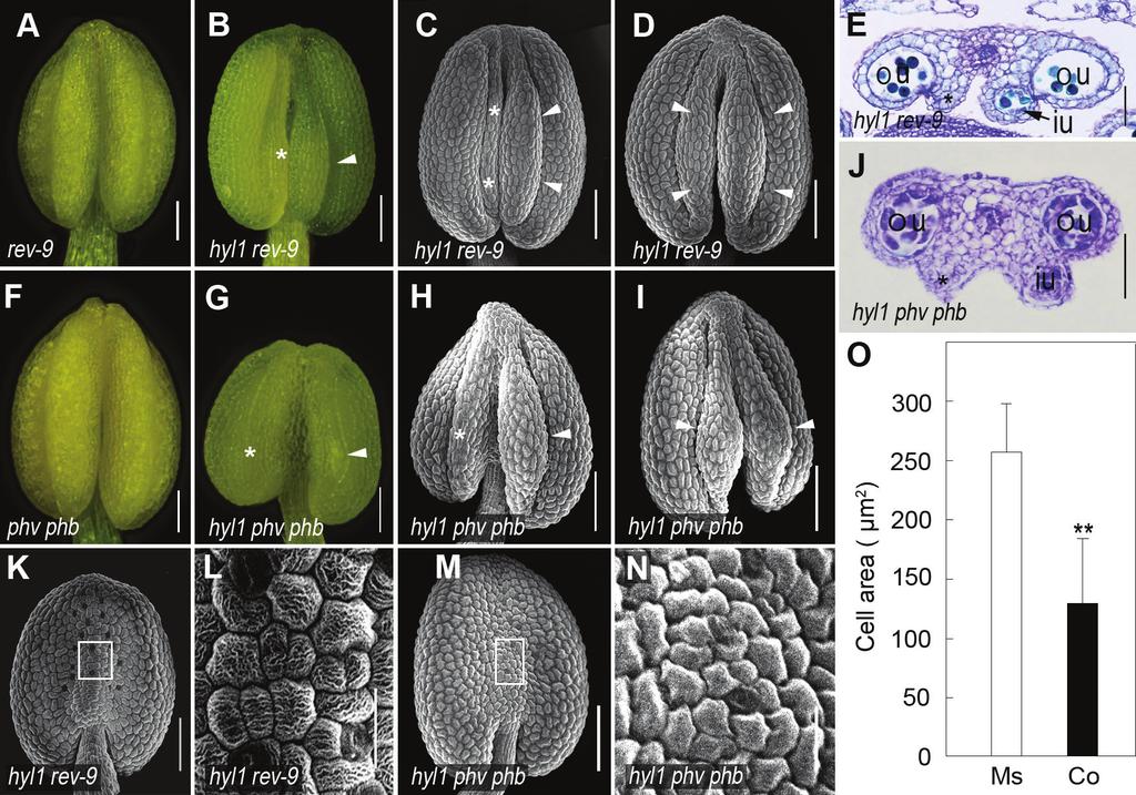 HYL1 in stamen architecture 3407 Fig. 8. Rescue of hyl1 stamen defects by the rev-9 and phv-5 phb-6 alleles. (A and B) Anthers of rev-9 and hyl1 rev-9 mutants.