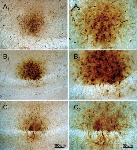 P11 egér, Asztro biocytin jelölése HC-ban, CA1 Kapcsoltság A1,A2: stratum radiatum közepén - koncentrikus B1 C2: stratum radiatum közel a piramissejt-réteghez : ekkor 2 féle jelölés B1,B2: biocytin