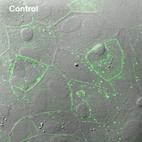Glia szincícium (syncytium) Kapcsoltság 1968-69 Gerschenfeld H.M.