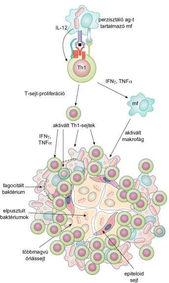 18.14. ábra A granulóma kialakulása és szerkezete DTH-reakció - fontos az intracelluláris bakt.