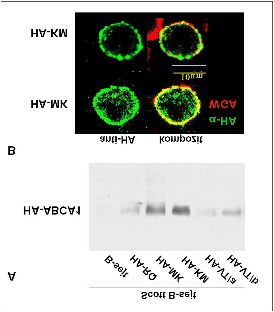 9. ábra: A HA-jelölt ABCA1 variánsok expressziója és sejten belüli lokalizációja Scott betegből származó EBV-transzformált B-sejtekben (A) A HA-jelölt ABCA1 variánsok expresszióját