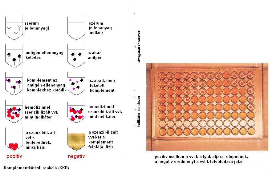 Komplementkötési reakció Pozitív esetben a vvt-k a vájulat