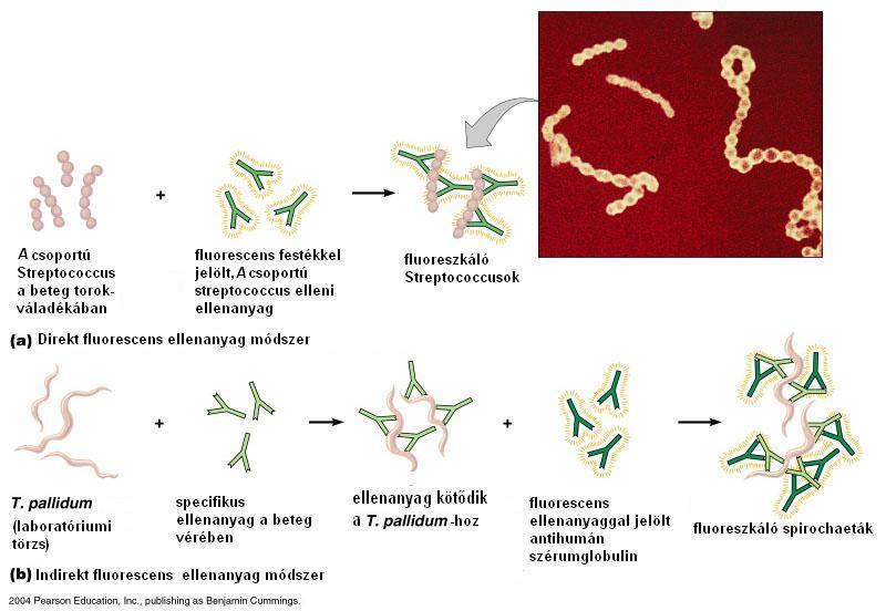 A csoportú Streptococcus a beteg torokváladékában Fluorescens festékkel jelölt, A csoportú Streptococcus elleni ellenanyag Fluoreszkáló Streptococcusok A) direkt immunfluorescencia T.