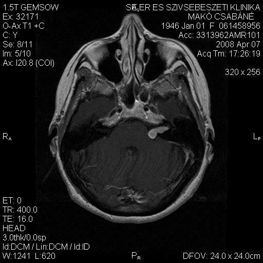 Kontrasztos MR vizsgálat 19 x 8
