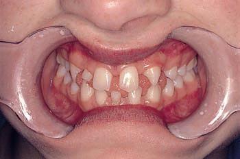 : Introduction to Orthodontics.
