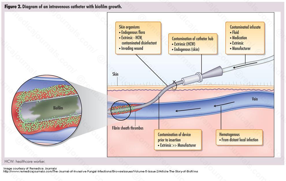 BIOFILM HATÁSA Immunhiányos állapot A páciensek 7%-a szenved el kórházi fertőzést az intenzív kezelések során (Franciao.