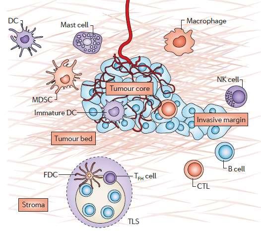 A tumorok immun-anatómiája A tumorokat a burjánzó sejtek, stromasejtek és a tumort infiltráló immunsejtek hálózata jellemzi. Ezek betegenként, tumor-típusonként változnak.
