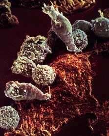 Tumorsejtek felismerése és elpusztítása Természetes ölősejtek