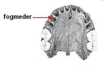 Fogmeder