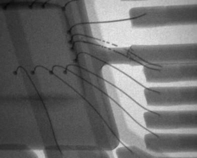 röntgensugár vákuumcső röntgensugár vákuumcső