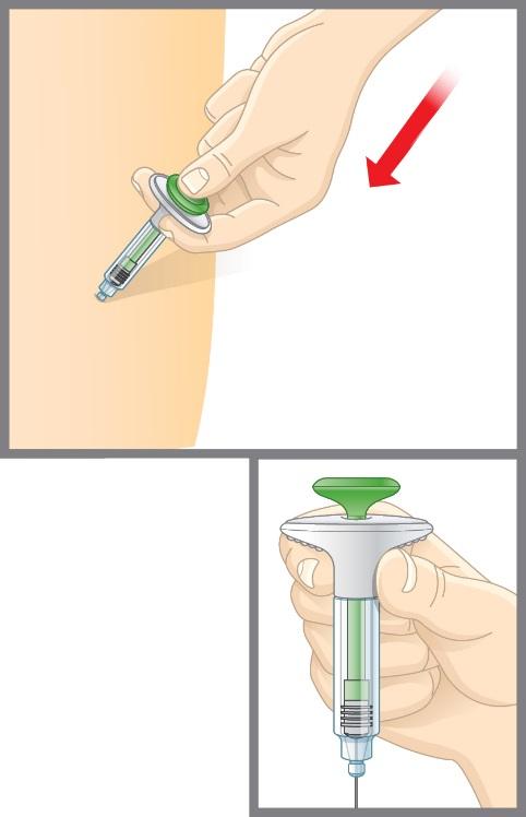 2d Nyomja be a dugattyút. Lassan nyomja be a dugattyút, végig, amíg az összes gyógyszert be nem adta. A szürke dugattyút egészen a fecskendő végéig be kell tolni. Óvatosan húzza ki a tűt a bőréből.