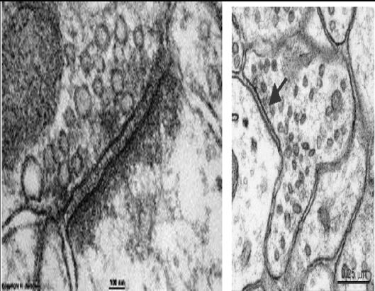 A kapcsolódás típusa alapján: Axodendritikus Axosomaticus Axoaxonális Axomyelinitikus II. A transzmitter típusa és funkciója alapján: 1.