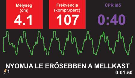 Bemutatjuk hivatásos mentőerőknek készült új defibrillátorunkat, amelyet a felhasználóknak nyújtandó páratlan támogatás, valamint az alacsony