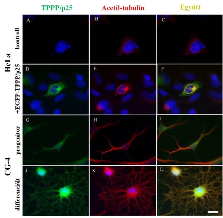10. ábra: A TPPP/p25 révén megnövekedett tubulin acetiláció immunfluoreszcens mikroszkópiás detektálása HeLa (A-F) és CG-4 (G-L) sejtekben.