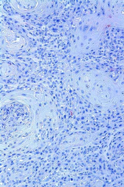 CD1a