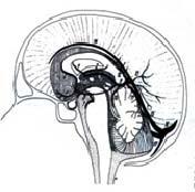 The Results of an International Study On Cerebral Vein and Dural Sinus Thrombosis (ISCVT) Prognosis of Cerebral Vein and Dural sinus thrombosis (624 pts.) José M.