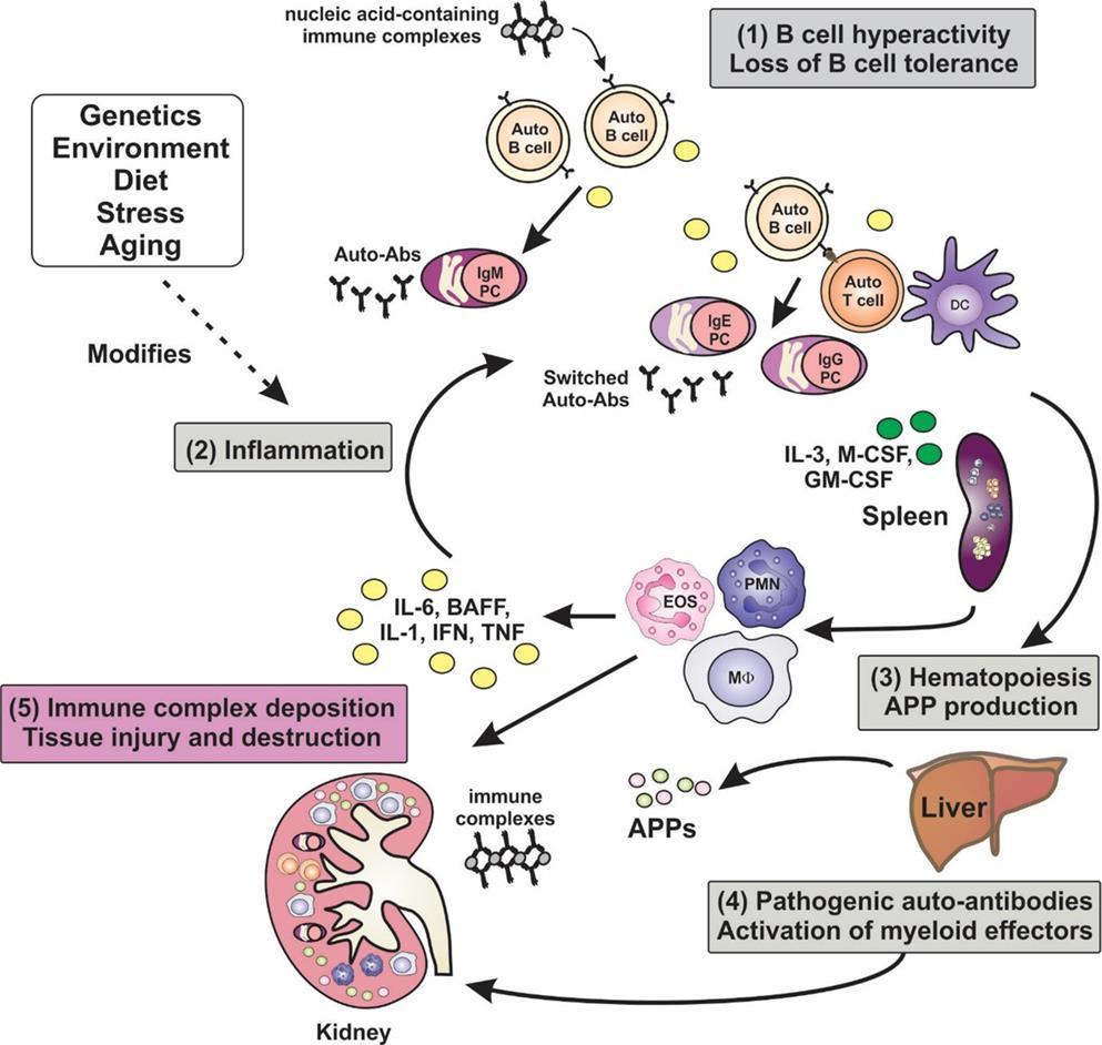 Szisztémás lupus erythematosus (SLE)