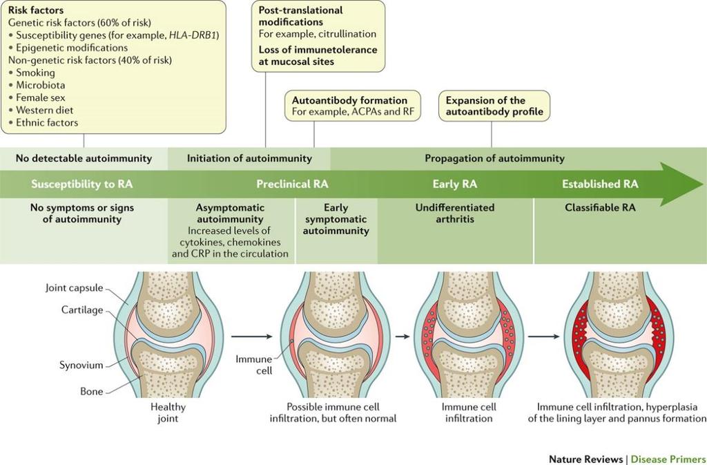 RA- Rheumatoid Figure 1 Development arthritis and progression patomechanizmusa of RA