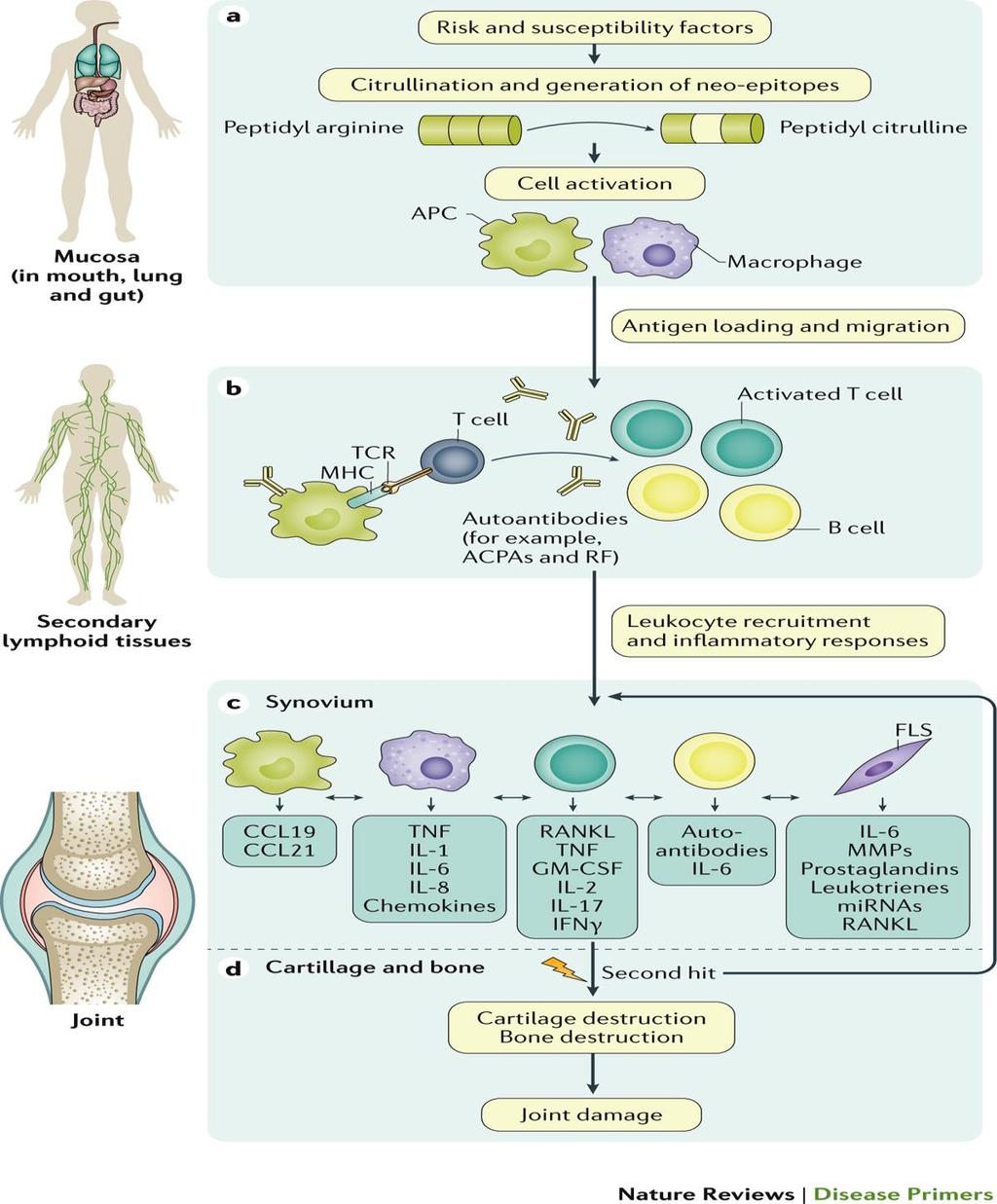 RA- Rheumatoid arthritis patomechanizmusa Figure 2 Mechanisms involved in initiation and progression of