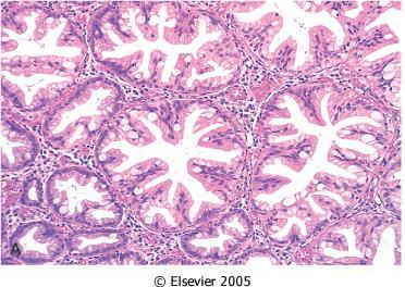 NEM NEOPLASTICUS POLYPUSOK II.