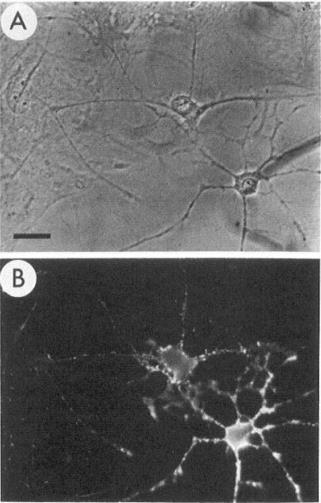 astrocyte: GFAP+, kiterült Type 2.