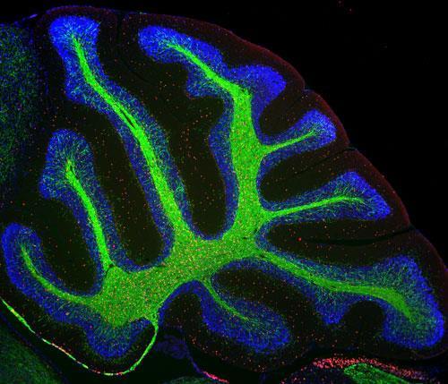 Oligodendrociták Humanized mice *glial progenitors from aborted human fetuses *PSA-NCAM- and A2B5+ magnetic separation *shi/shi x rag2/-/- myelin and immunodeficient mice