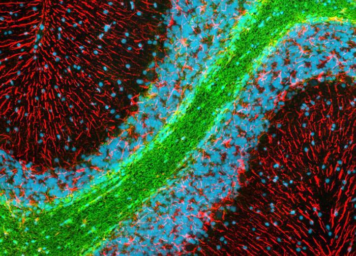 transplanted with human precursor cells. Since the mutant mouse s own cells cannot make MBP, (shiverer) all the myelin has been produced by the human cells.