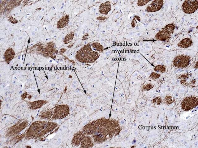 Oligodendrociták MBP, myelin basic protein (MBP) in