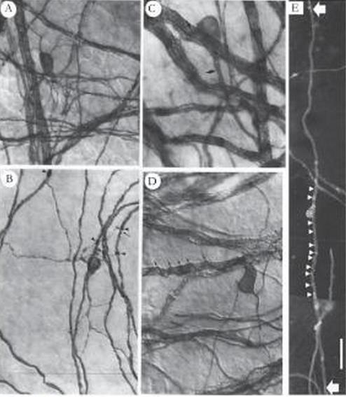 Adult rat anterior medullary.