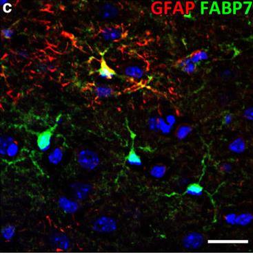 FABP7 (BLBP) Fatty acid binding protein 7 Brain lipid binding protein hosszú szénláncú zsírsavak és
