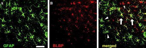 radiális gliában is Érdekes: FABP7 köti a legerősebben a FABP család tagjai közül a DHA-t