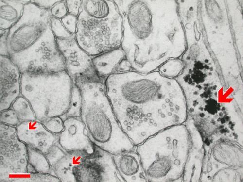 http://synapses.clm.utexas.edu/anatomy/astrocyte/glycogen.stm http://captain-nitrogen.tumblr.