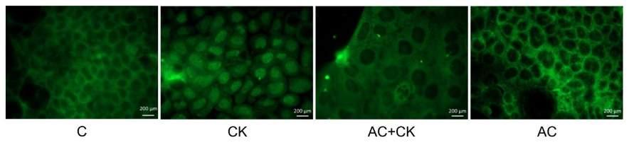 GYULLADÁS HATÁSA CACO- MODELLEN 1. Citotoxicitás Real Time Cell Analysis (RTCA) A vizsgálatok során alkalmazott 5 µm antocianin kivonat nem citotoxikus.