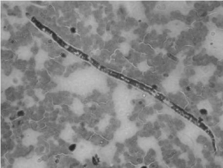 Microfilaria HWD-ben beteg kutya vérében (Vörös et al. 2000, Magyar Áorv. Lapja, 122. 707-716) Giemsa szerint festett Dirofilaria immitis microfilaria vérkenetben.