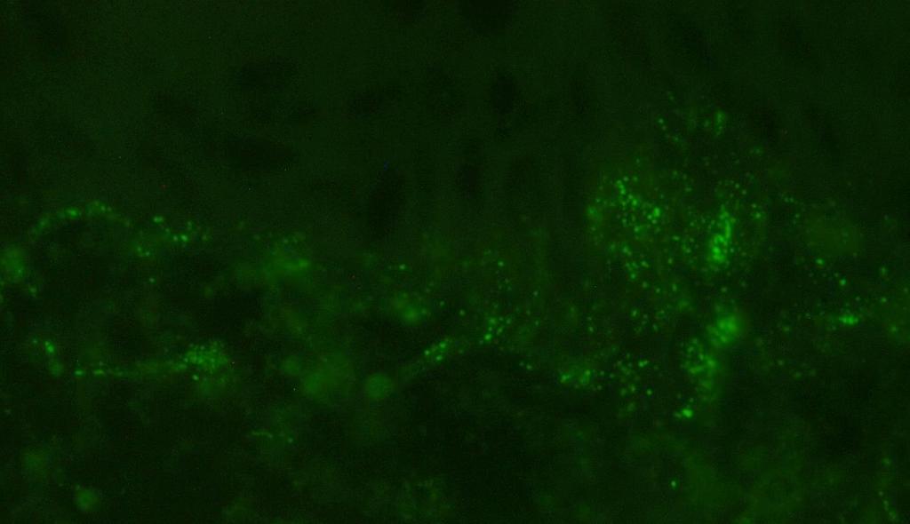 Epidermis Dermis