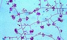 Aspergillus