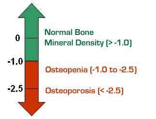 Osteodensitometria A combnyak feletti BMD érték a legfontosabb, vagy a teljes test BMD érték.