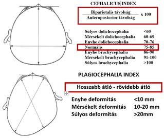 A koponya különböző átmérőinek felhasználásával lehetőségünk van az úgynevezett kefalikus index (CI) és a plagiokefália-index (PI) meghatározására is. [4] 3.