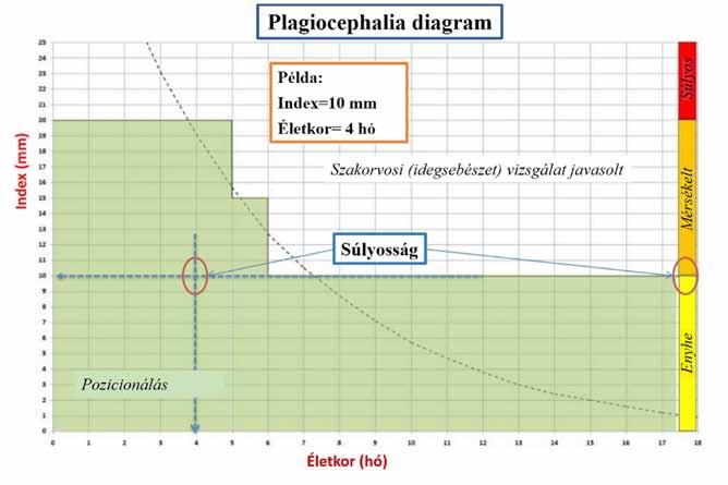 5. ábra Plagiokefália-kezelési útmutató diagram.