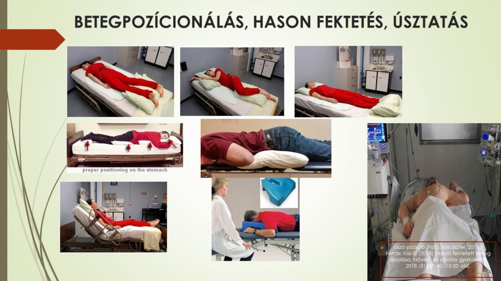 A párnákkal való alátámasztás elősegíti a mellkas és a has szabad mozgását, ezzel megakadályozva az intraabdominális nyomásfokozódást.