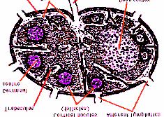 Ma l i g n u s FELOSZTÁS Klinikum + Morfológia + Fenotípus + Genotípus PRECURSOR ALL/ LYMPHOBLASTOS LYMPHOMA NON HODGKIN Érett B-sejtes Érett (perifériás)t-sejtes HODGKIN LYMPHOMA low grade